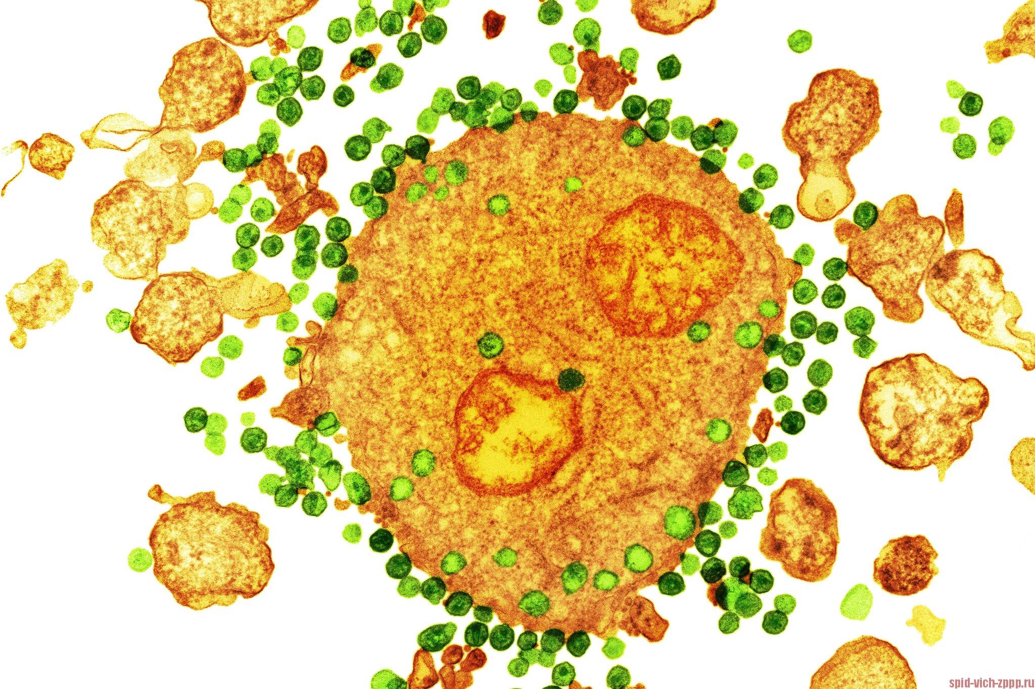 Фото инфицированного ВИЧ лейкоцита с помощью цветной просвечивающей электронной микроскопии.