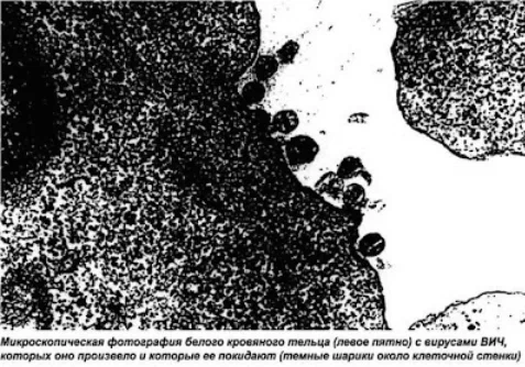 Микроскопическая фотография белого кровяного тельца (левое пятно) с вирусами ВИЧ, которых оно произвело, и которые её покидают (тёмные шарики около клеточной стенки). 